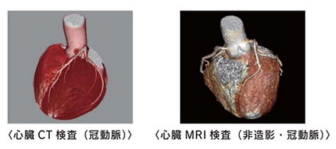 心臓CT検査（冠動脈） 心臓MRI検査（非造影・冠動脈）