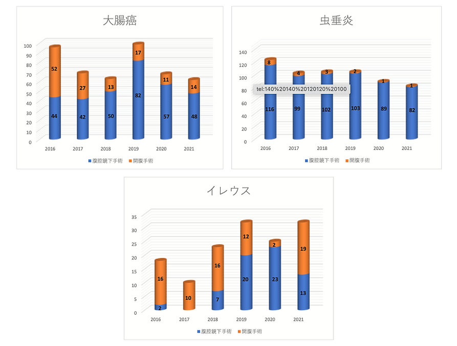 大腸癌 虫垂炎 イレウス